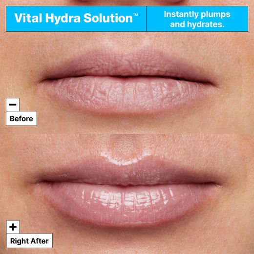 DR.JART+ Vital Hydra Solution™ Hydrating Lip Mask