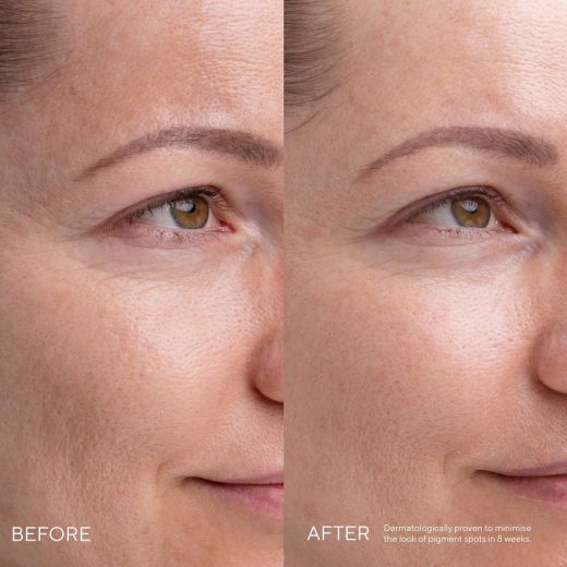 MADARA Kojic Alternative Pigment Serum