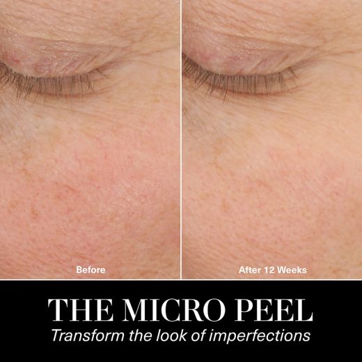 LA MER The Micro Peel
