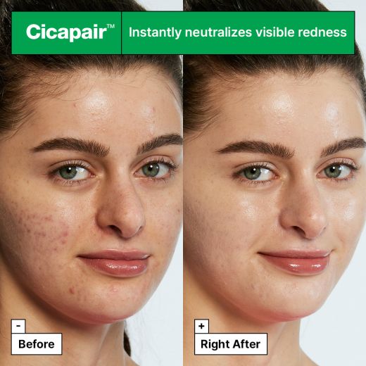 DR.JART+ Cicapair™ Tiger Grass Colour Correcting Treatment