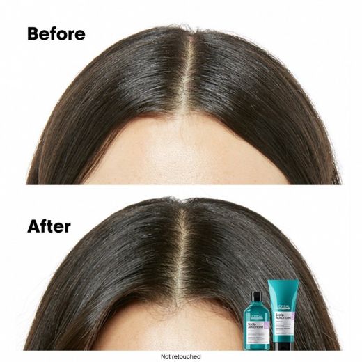 L'ORÉAL PROFESSIONNEL PARIS Scalp Advanced Anti-Discomfort Dermo-Regulator Shampoo