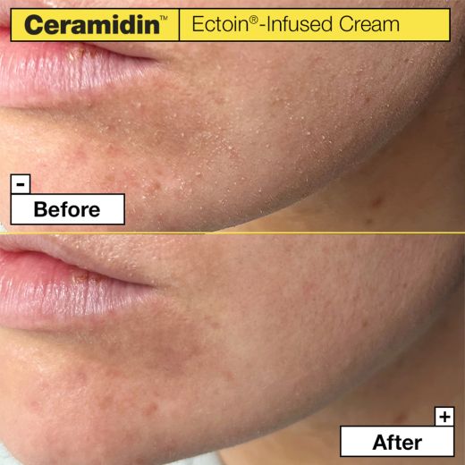 DR.JART + Ceramidin™ Ectoin®-Infused Cream