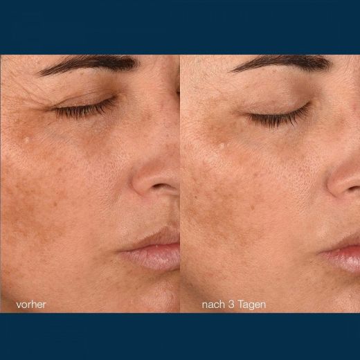 DERMALOGICA Pro Collagen Banking Water Cream
