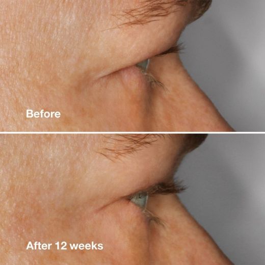 CLINIQUE High Impact Lash Amplifying Serum