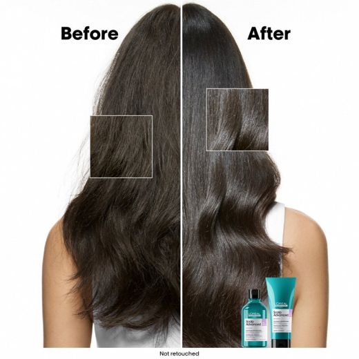 L'ORÉAL PROFESSIONNEL PARIS Scalp Advanced Anti-Discomfort Dermo-Regulator Shampoo