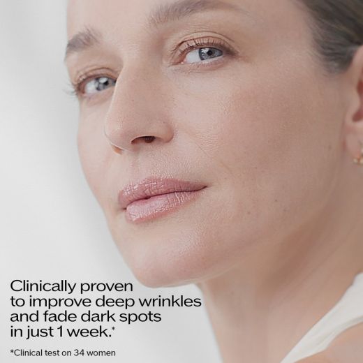 SHISEIDO Vital Perfection Intensive Wrinklespot Treatment A+