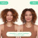 AMIKA The Kure Multi-Task Repair Treatment